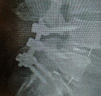 LRM_EXPORT_20180313_172625~2.jpg