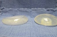 saline-breast-implant-deflated-post.jpg