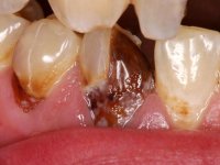 methmouth5.jpg
