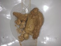 Human_feces_containing_barium_sulfate_suspension.jpg