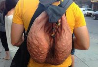 UNILAD-ballsack-WEB85308.jpg