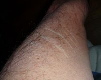 arm scratch.JPG