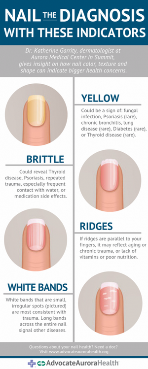 fingernail_indicator_infographic_3.4.png